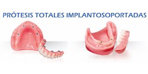 Jornada:  Soluciones con Prótesis Implantosoportada
